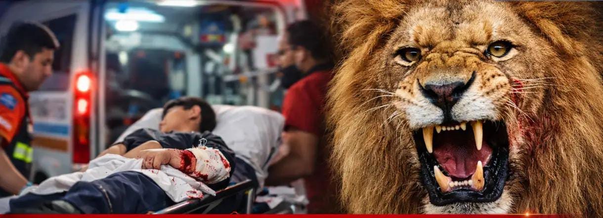 Child Critically Injured by Pet Lion in Lahore’s Sabzazar; Authorities Take Legal Action